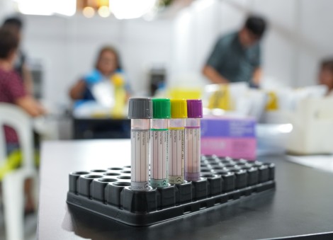 473 people test positive for tuberculosis after Bedok screenings