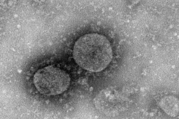 Hong Kong researchers have developed coronavirus vaccine, expert reveals