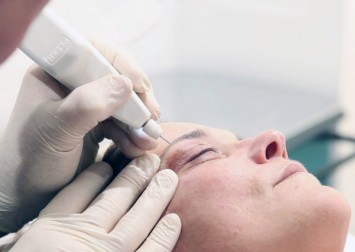 What you need to know about skin needling, microdermabrasion and thermage aesthetic treatments