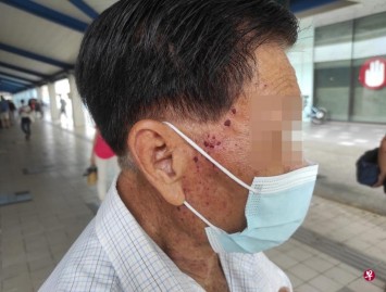 Elderly man charged $4,500 for facial: Tampines salon says he had 220 oil seeds, police looking into matter